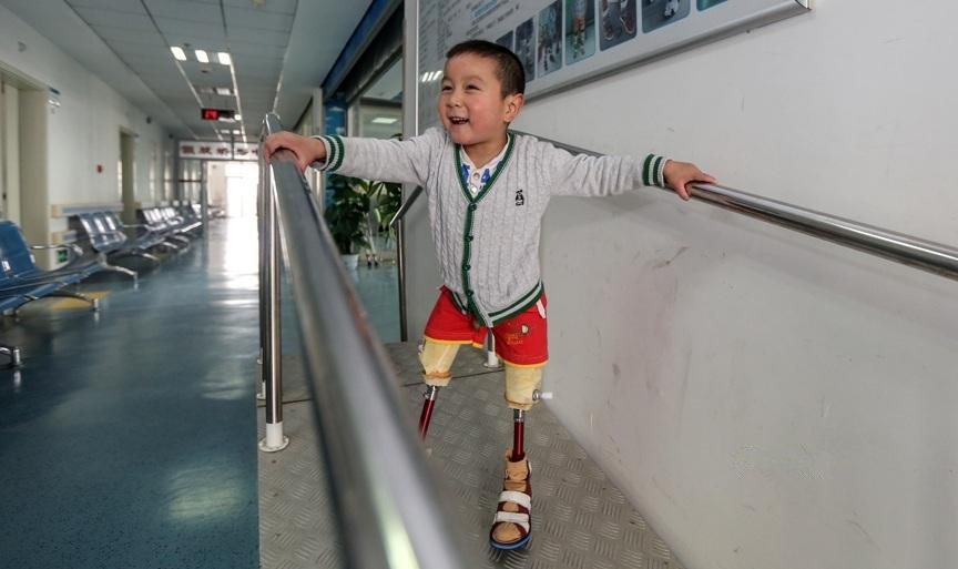 跳小苹果的截肢男孩装上假肢重新站立